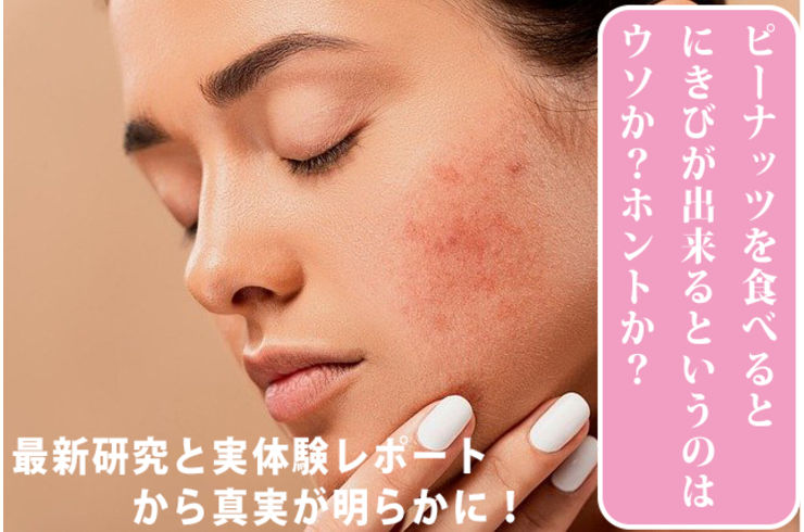 ピーナッツでニキビは増える？60日検証でわかった原因・適量・食べ方【落花生専門店】
