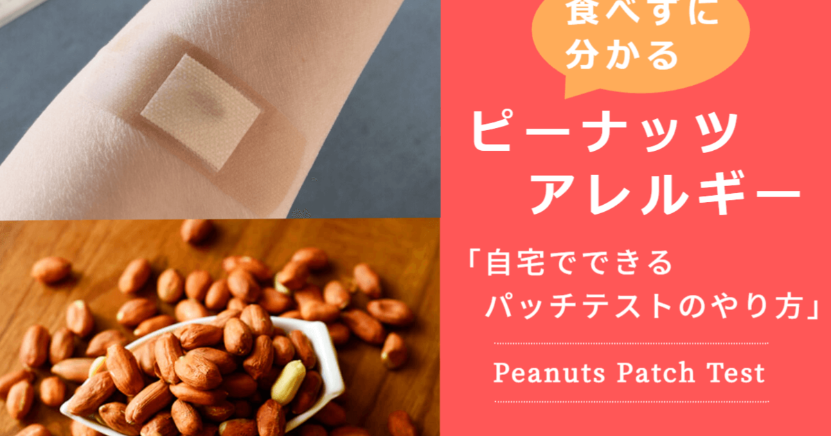 ピーナッツアレルギーか食べずに分かる簡単なパッチテストのやり方