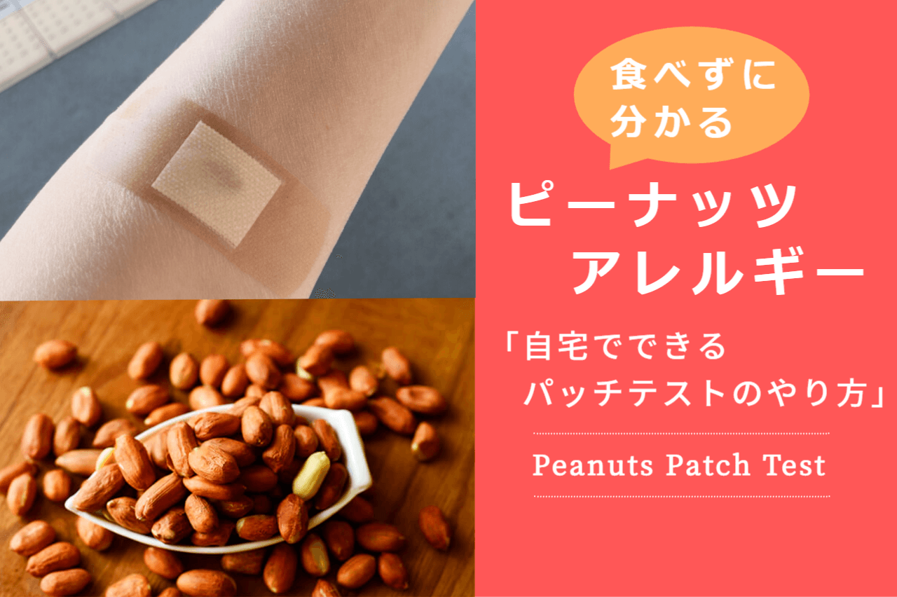 ピーナッツアレルギーか食べずに分かる簡単なパッチテストのやり方