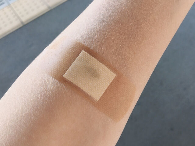 腕　パッチテスト.jpg